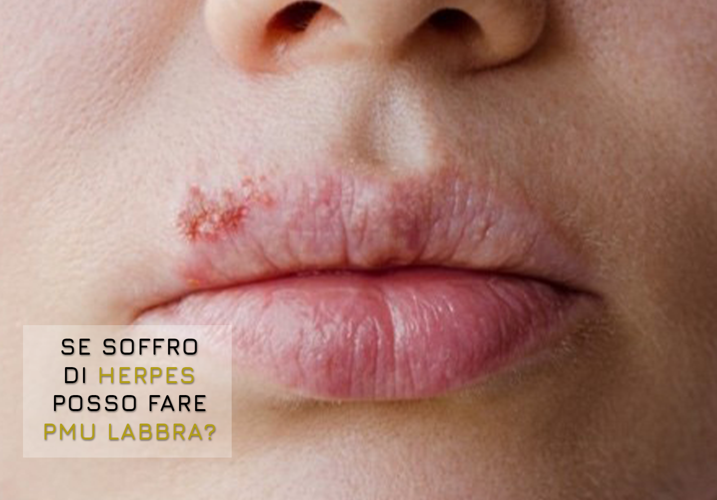 herpes-labbra-posso-fare-lip-tattoo